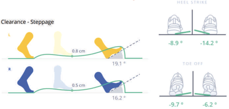 Case Study 10 – Paromed – Custom orthotics & German engineered ...