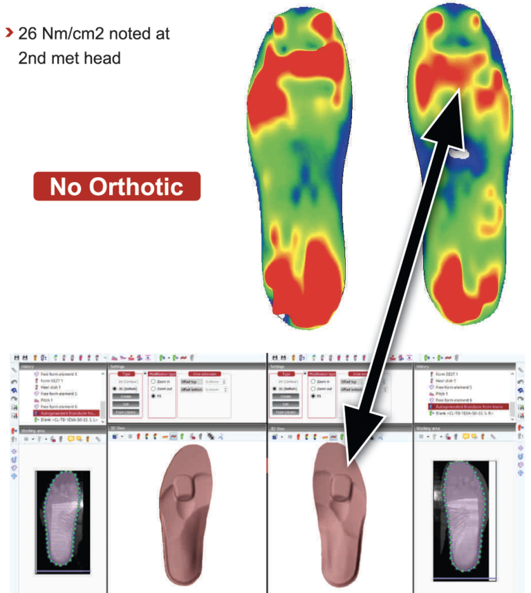Case Study 10 – Paromed – Custom orthotics & German engineered ...