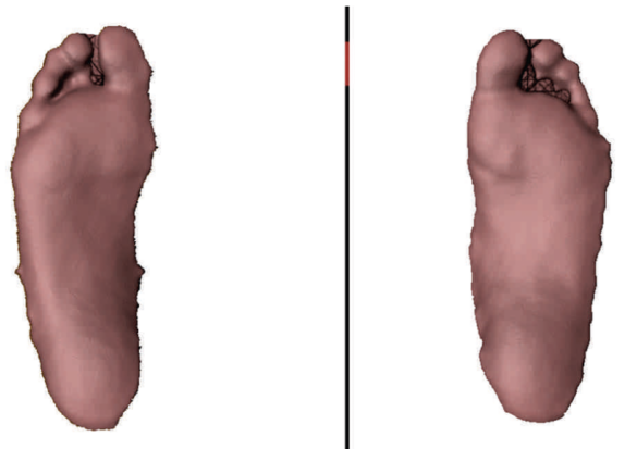 Case Study 10 – Paromed – Custom orthotics & German engineered ...