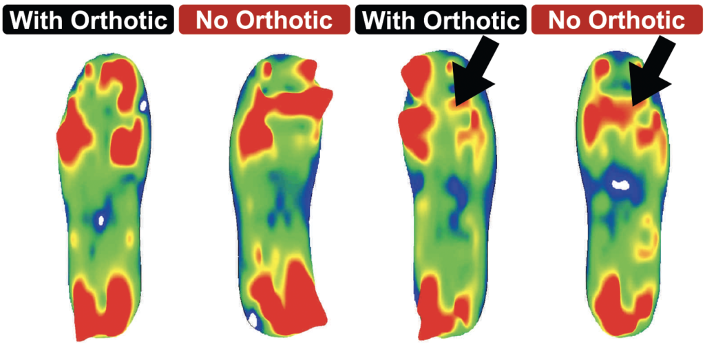 Case Study 10 – Paromed – Custom orthotics & German engineered ...
